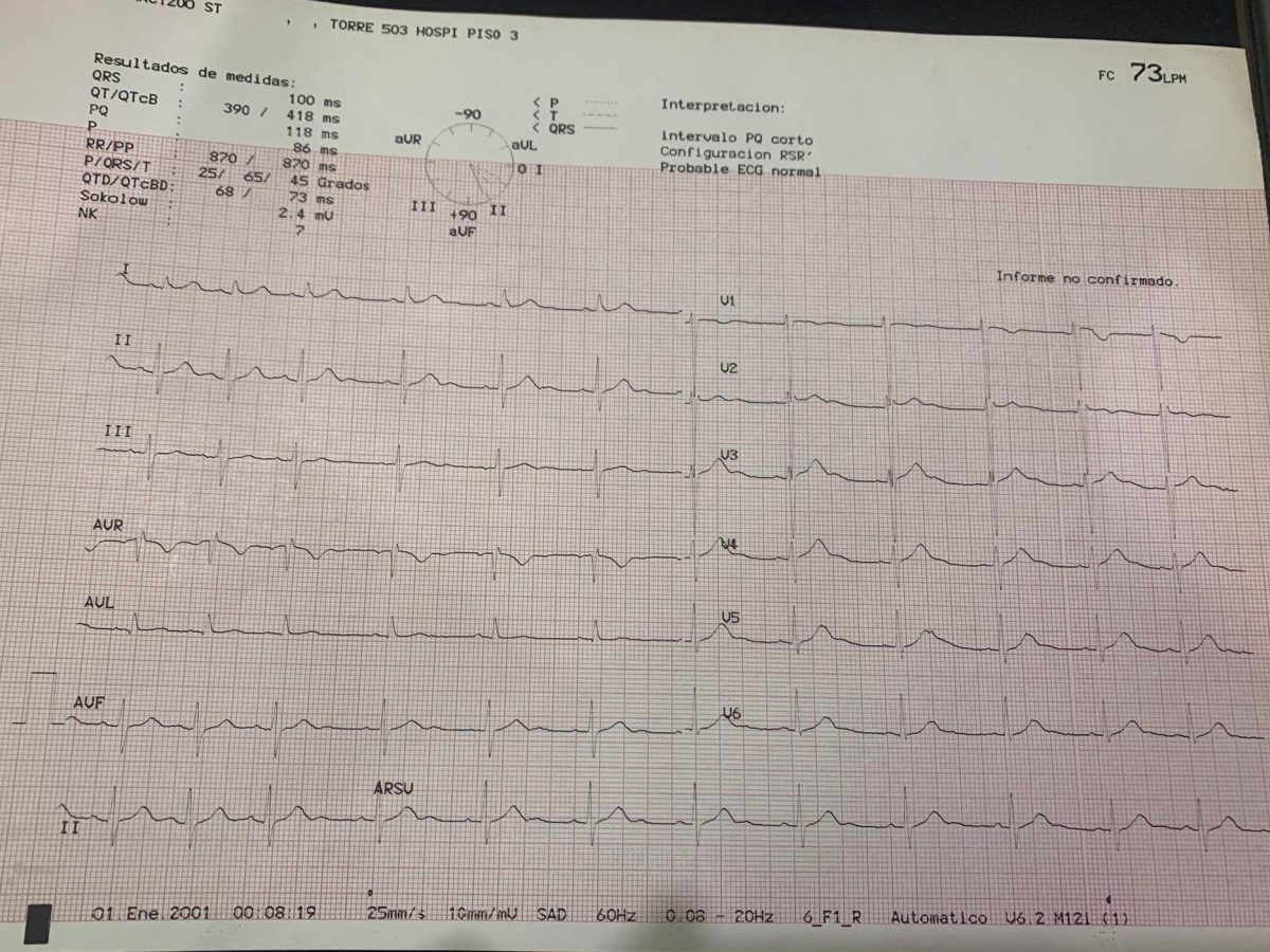 Tengo alteraciones en mi electrocardiograma